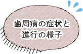 歯周病の進行と症状