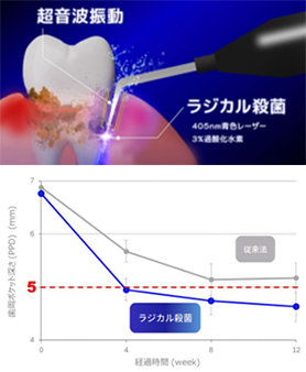 ブルーラジカルのメカニズム